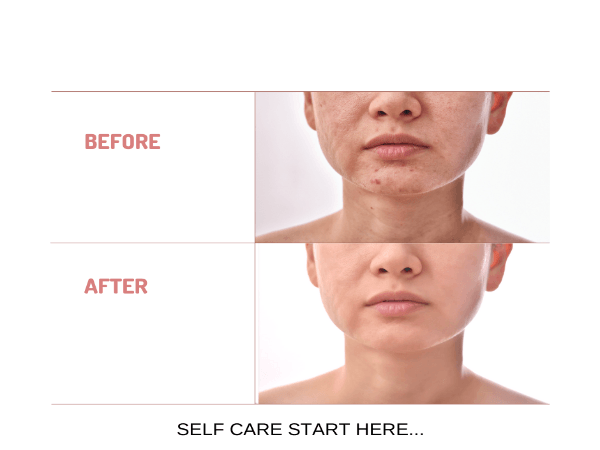 Organic Under Eye Youth Corrector and Neck Renewal Cream Duo - For Women - Tiny Tim SkincareOrganic Under Eye Youth Corrector and Neck Renewal Cream Duo - For WomenOnyx Skin Care LineTiny Tim Skincare601956330861601956330861Organic Under Eye Youth Corrector and Neck Renewal Cream Duo - For Women