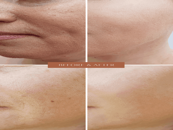 ORGANIC HYALURONIC WRINKLE DEFIER - For Women and Men - Tiny Tim SkincareORGANIC HYALURONIC WRINKLE DEFIER - For Women and MenHyaluronic Wrinkle Defyer SpritzOnyx Skin Care LineTiny Tim Skincare601956330632601956330632ORGANIC HYALURONIC WRINKLE DEFIER - For Women and Men