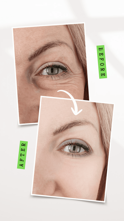 ORGANIC UNDER EYE YOUTH CORRECTOR - For Women - Tiny Tim SkincareORGANIC UNDER EYE YOUTH CORRECTOR - For WomenHealth &amp; BeautyOnyx Skin Care LineTiny Tim Skincare660457972352660457972352ORGANIC UNDER EYE YOUTH CORRECTOR - For Women